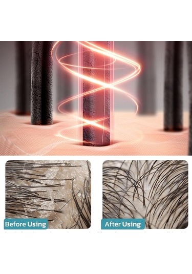 Artfulabode Şarjlı Saç Bakım Fırçası - Kırmızı Işıklı Masajlı Yağ Uygulayıcı Beyaz Beyaz