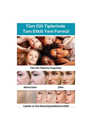 İlla Life Cilt Beyazlatıcı Leke Kremi 50 ML