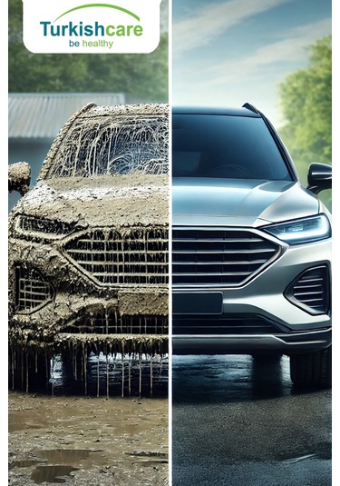 Turkishcare Oto Cam Temizleyici 500 ML