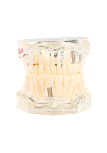 Samdoo Diş Sağlığı Eğitim Modeli: Şeffaf, Ayrılabilir Mandibula Ve Maksila - Diş Yapısı Ve İmplantasyon Öğretimi Çok Renkli