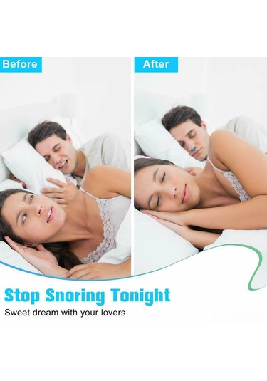 Mufunye Burun Tıkanıklığını Gideren Horlama Önleyici Cihaz, Abs Ve Silikon Malzeme, Kırmızı/mavi/beyaz Renk Seçenekleri