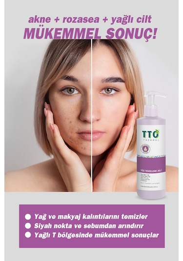 Tto Karma ve Yağlı Ciltler için Yüz Temizleme Jeli 150 ML