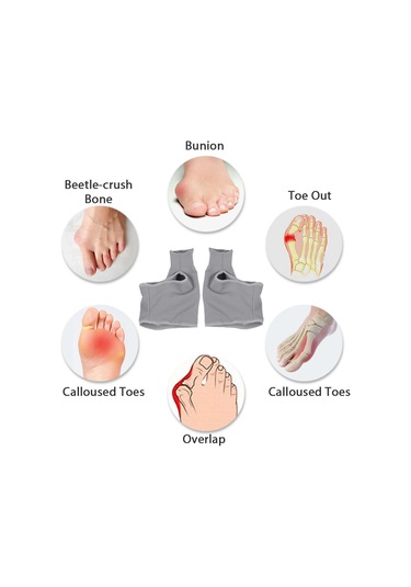 Moveevo Halluks Valgus Düzeltici Ayak Örtüsü Ayak Bakım Örtüsü Bir Çift Gri Küçük Boy
