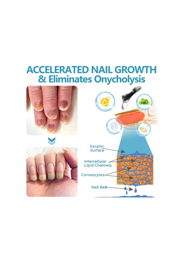 Eelhoe Eelhoe 15 Ml Tırnak Tırnak Eti Bakımı Özü Tırnak Onarıcı