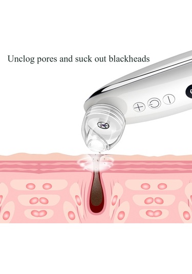 Sones Siyah Nokta Elektrikli Gözenek Temizleme Makinesi Temiz Yüz Ekipmanı, Stil: Tabansız