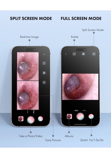 Anykit Dijital Otoskop, Ultra Net Görüşlü Kulak Kamerası - İpad/iphone/android