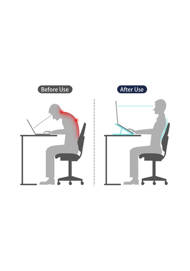 Wiwu S400 Laptop Standı Gümüş