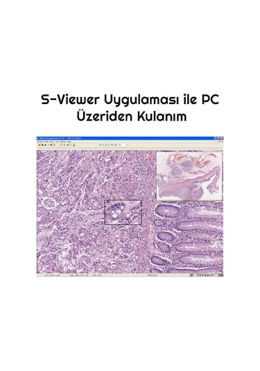 Triline 2000x Zoom Biyolojik Hd Dijital Monoküler Mikroskop Kiti