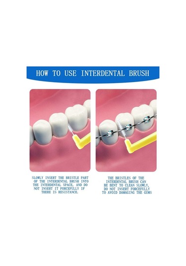 Sones 10 Adet / Paket Ortodontik Dişler Diş Arası Fırçalar Diş Teli Tel Yumuşak Kıllar Sarı