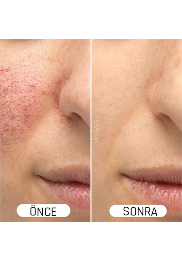 Vitayes Vitamin C + Hyaluronik Asit Serum 2 x 30 ML