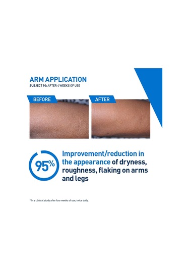 Cerave Nemlendirici Vücut Losyonu 473ml