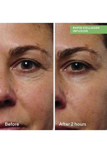 Murad Collagen Infusion Anında Sıkılaştırıcı Kolajen Serumu 30 Ml