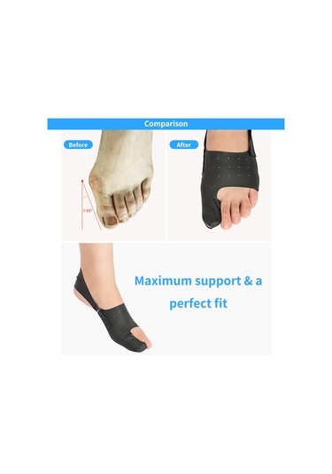 Moveevo Yetişkin Halluks Valgus Düzeltici Nefes Alabilen Giyilebilir Ayakkabı Ten Rengi L Beden Tek