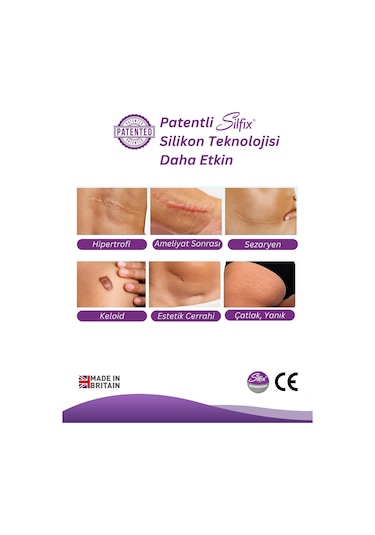 Advancis Medical UK Siltape Soft Silikon Yara İzi Dikiş İzi Sezaryen Yanık Estetik Bant 2 CM x 3 M