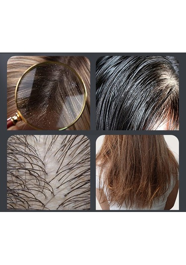 Suntek Saç Yağı Aplikatör Kafa Sıvısı Fırçası Baş