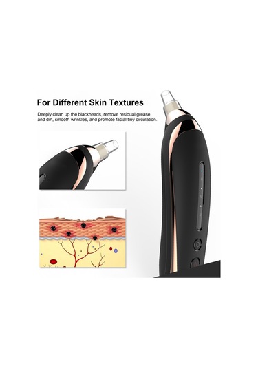 Hangfox Yüz Temizleme Aleti: Abs Malzeme Akne Karaburun Çıkarıcı, 500mah Pil, 3 Seviye Emme Gücü, 4 Farklı Uç, Gümüş Beyaz