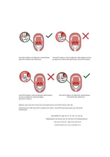 Somnofit-s, Mandibular Alt Çene İlerletme Aparatı