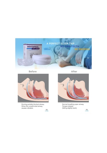 Qingmipy Gece Diş Gıcırdatma Önleyici Ayarlanabilir Dişlik, Beyaz Renk, Rahat Kullanım