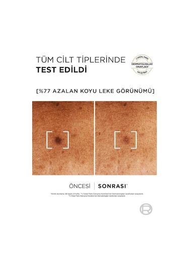 L'Oréal Paris Bright Reveal Koyu Leke Karşıtı Serum 30 ML