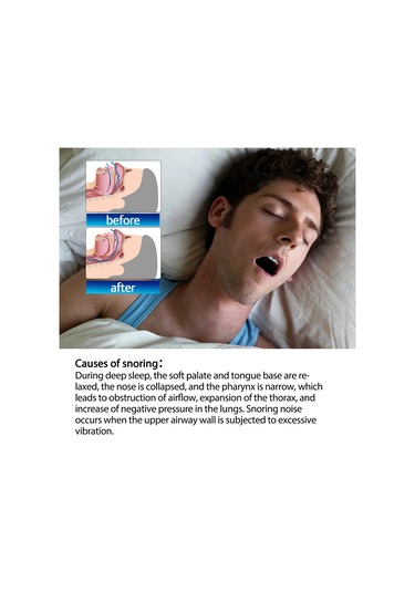 Vkemall South Moon Stop Horlama Burun Bantları Daha İyi Uyku Sağlar Daha İyi Nefes Alır Bej