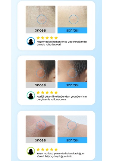 Yatıştırıcı Ve Önleyici Mikro İğneli Bant Soothing Care Microcone Patch 12 Li