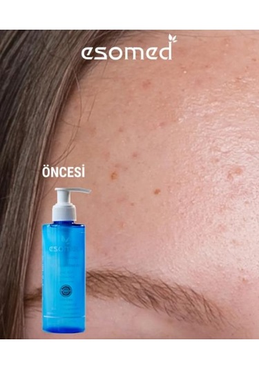 Esomed Yüz Temizleme Jeli 200 Ml