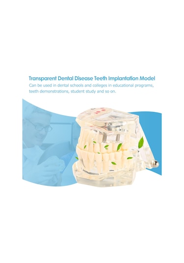 Samdoo Diş Sağlığı Eğitim Modeli: Şeffaf, Ayrılabilir Mandibula Ve Maksila - Diş Yapısı Ve İmplantasyon Öğretimi Çok Renkli