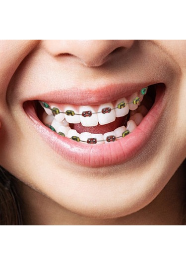 Skycity Gerçekçi Diş Teli Simülasyonu: Çeşitli Renklerle Başlangıç Seviyesi İçin Mükemmel Eğitim Aracı