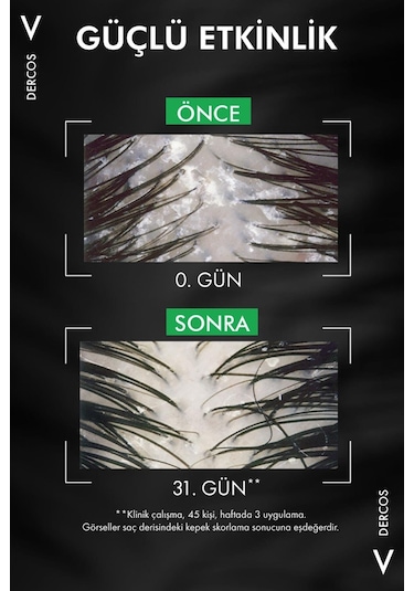 Vichy Dercos Anti-Dandruff Karşıtı Şampuan Normal & Yağlı Saçlar 2 x 390 ML