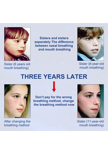 Vkemall Elaımeı Anti Horlama Uyku Bantları Tek Kullanımlık Ağız Bantları Bant Ağız Kurul Beyaz