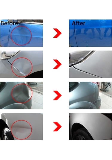 Sones 12'si 1 Arada Araç Göçük Düzeltme Aleti Seti Ücretsiz Sac Göçük Düzeltme Çektirmesi