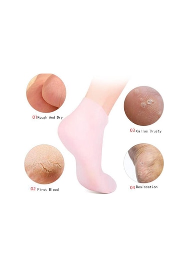 Suntek Yumuşak Silikon Jel Çorap Ayak Çorabı Koruma Beyaz-m