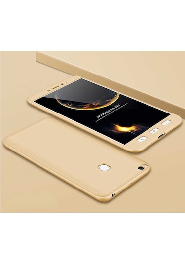 Xiaomi Mi Max 2 Kılıf Zore Ays Full Koruma Kılıf