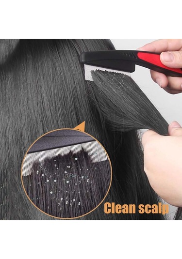 Hombey Stainless Steel Saç Kefesi Seti: İnce Dişli Kuru Kül Alıcı Ve Boşluklu Dişli Baş Derisi Masaj Aleti Siyah Diğer