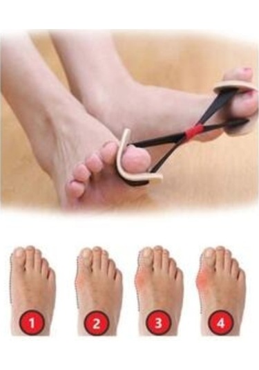 Ayak Parmak Egzersiz Lastiği Aleti