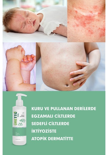 Üretto Baby Vüct Losyonu 200 Ml