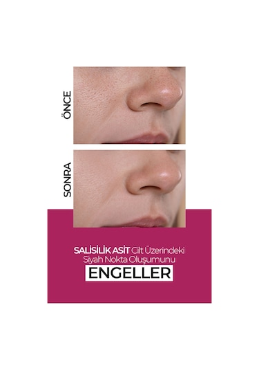 New Well Leke Karşıtı Cilt Bakım Kremi 50 ML
