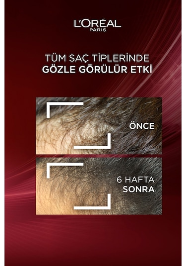 ELSEVE Komple Direnç Dökülme Karşıtı Şampuan 300 ml