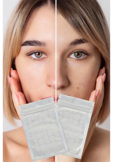 Akne Sivilce Siyah Nokta Bandı 72 Adet Sos Band Bant