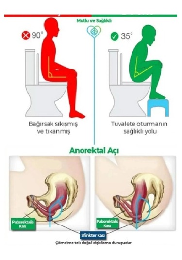 Klozet Çömelme Ayak Taburesi, Wc Basamak, Wc Tuvalet Taburesi, Kl