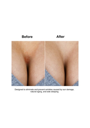 Mufunye Gece Boyu Rahatlık Sağlayan İnce Silikon Göğüs Pedi - Cilt Dostu Ve Yumuşak