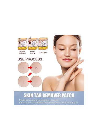 Mufunye Doğal İçerikli T-ag Cilt Yapışkanları - Tüm Cilt Tipleri İçin, 144 Adet, Su Geçirmez Ve Nefes Alabilir