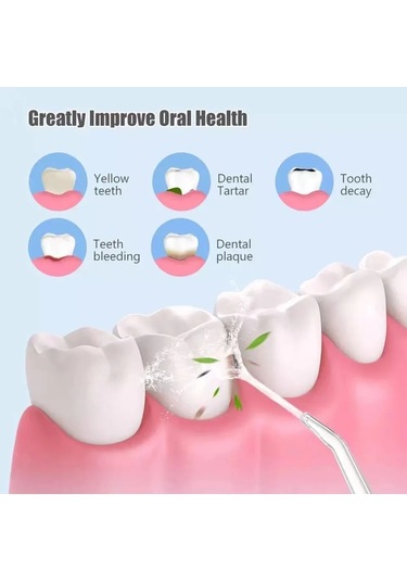 Oral Irrigator Aksesuarları Ev Ağız Temizleme Diş Temizleme Nozulu, Stil: Dil Temizleme Nozulu