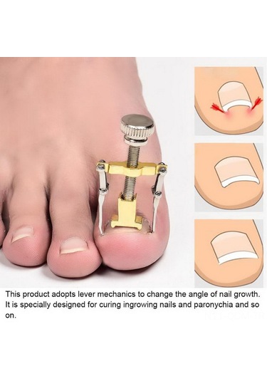 Qingmipy Altıparmak Tırnağı Düzeltme Aracı - İçbükey Tırnak Sorunu Çözücü - Paslanmaz Çelik Altın