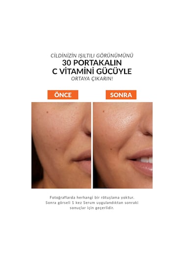 Anew Vitamin C Canlandırıcı Serum 30 Ml. İkili Set
