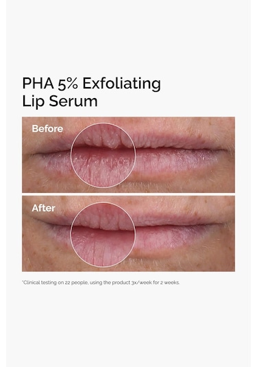 The Ordinary Pha %5 Peeling Etkili Dudak Serumu 15ml
