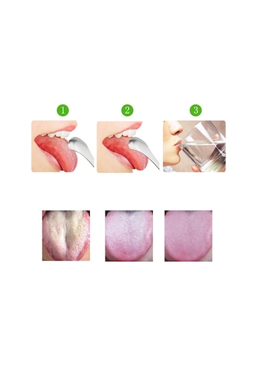 Sones Dil Temizleyici Ağız Kokusu Paslanmaz Çelik Temizleme Fırçası Dil Kazıyıcı + İki Parçalı Set Gül Altın