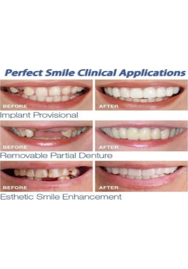 Hangfox Geçici Diş Kaplama, Üst Ve Alt Dişler İçin Dekoratif Protez, Kolay Takılabilir, Hemen Düzenli Parlak Dişler, Güvenli Konforlu Malzeme