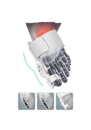 Akestoria Med Ayarlanabilir Cırtlı Baş Parmak Kemik Sönger Düzeltici Fc-053 Standart