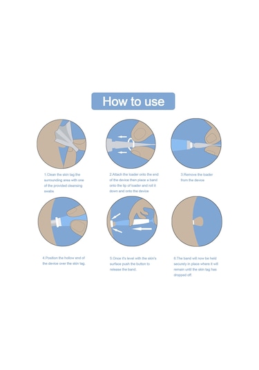 Teltree Cilt Et Beni Çıkarma Kalemi - 4-6mm Et Beni, Siğil Ve Nasır Temizleme Aleti Çok Renkli